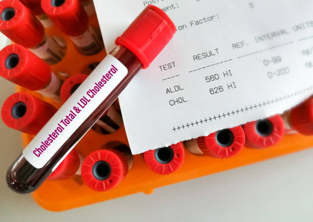 Bad Cholesterol
