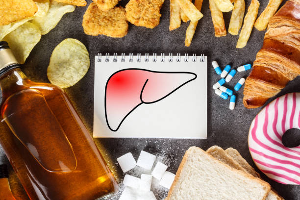 Fatty liver (photo credit -google)