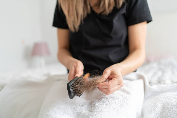 Hair Fall Tips (photo credit-google)