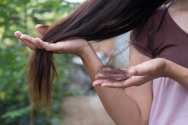 Hair Fall Tips (photo credit-google)
