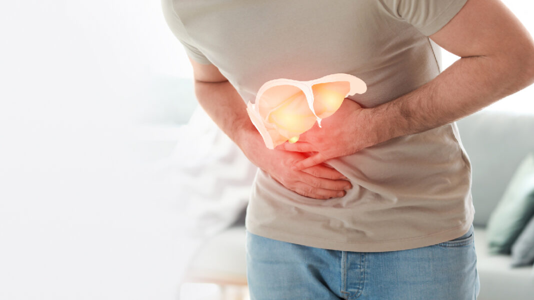 Fatty Liver (photo credit -google)